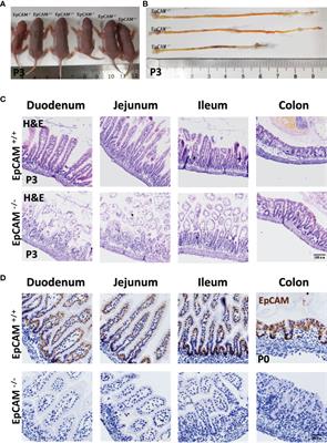 EpCAM Is Essential to Maintaining the Immune Homeostasis of Intestines via Keeping the Expression of pIgR in the Intestinal Epithelium of Mice